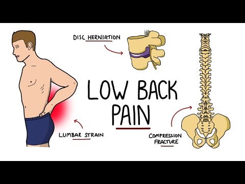 Low Back Pain Explained (Including Red Flags)