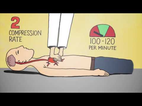 6 Easy Steps of CPR - Animation